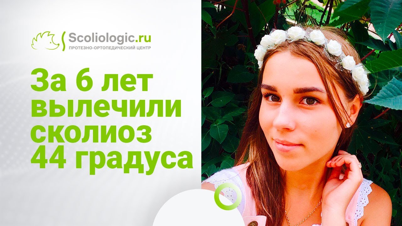 Корсет Шено. История 6-ти лет со сколиозом Насти Жосан.