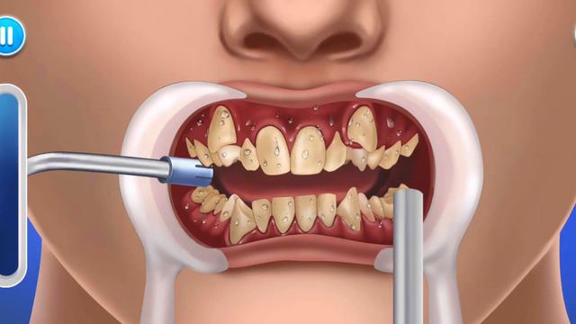 ASMR - Dental care 🦷 Hospital Doctor . АСМР - Лечение зубов , установка брекетов 👨⚕️ смотреть онлайн