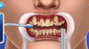 ASMR - Dental care 🦷 Hospital Doctor . АСМР - Лечение зубов , установка брекетов 👨⚕️