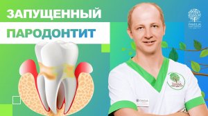 ? Запущенный пародонтит