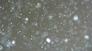 Молочнокислые бактерии, положительный фазовый контраст