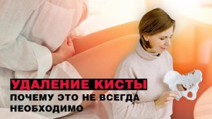 Удаление кисты: почему это не всегда необходимо