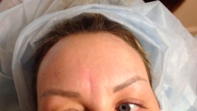 Аириском студенты учатся: семинар для студентов по введению мезонитей - губы, брови смотреть онлайн