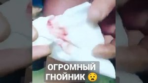 Огромный гнойник