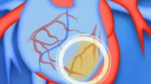 Мультфильм Защити свою кровеносную систему