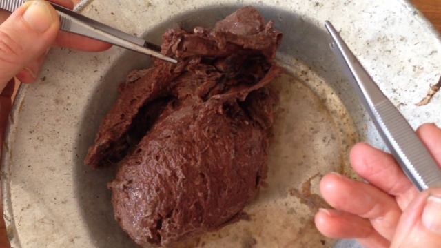 Строение сердца. смотреть онлайн