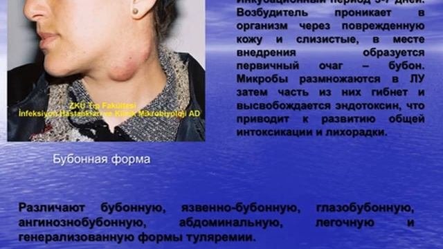 Особо опасные инфекции. Зоонозные инфекции