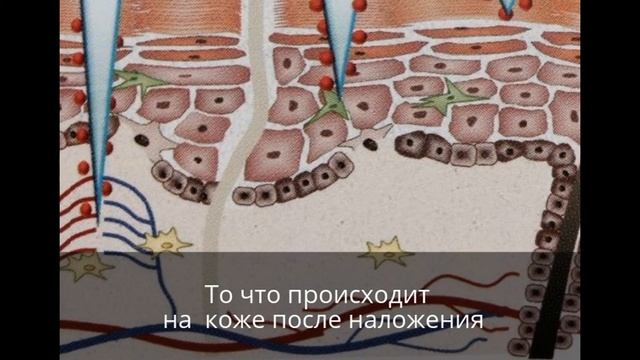 Инновационные микроиглы гуалуроновой кислоты смотреть онлайн