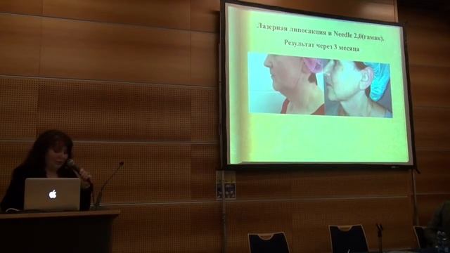 Olga Gaziulina - APTOS Monaco 2014 (Ольга Газиулина - АПТОС) смотреть онлайн