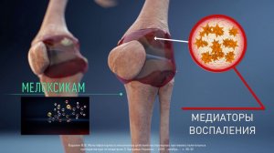 Терафлекс. 3D анимация