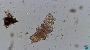 Тихоходка (Tardigrada)