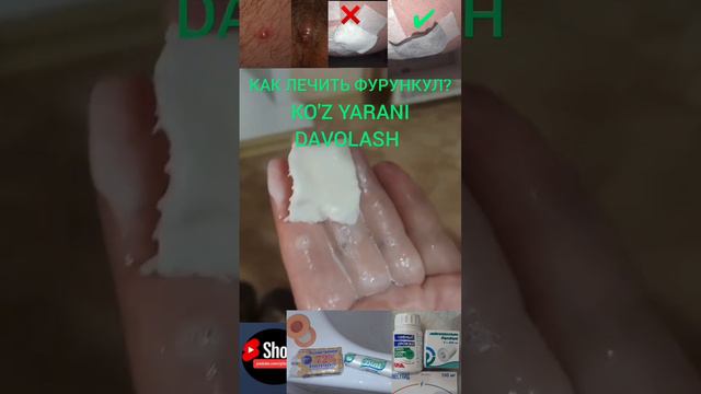 КАК ЛЕЧИТЬ ФУРУНКУЛ, KO'Z YARANI (CHIPQONNI) DAVOLASH UY SHAROITIDA JUDA FOYDALI 👏👏👏