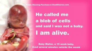 Tears Of Abortion - Story of an aborted baby, This ProLife Video will make you cry your eyes out.