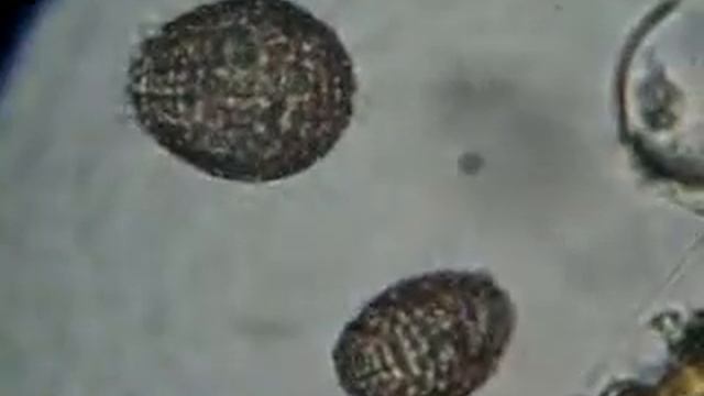 Ужасные Инфузории Coleps sp. в Воде из Пруда, Украина, Киев смотреть онлайн