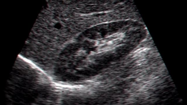 Что такое УЛЬТРАЗВУК и на что он способен? смотреть онлайн
