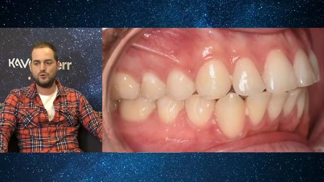 КНО 2020, Star Trek I, Поколение смотреть онлайн