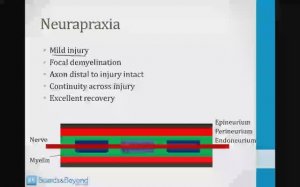 Неврология USMLE - 1. Введение - 2.Повреждение нервов