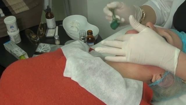 Второй подбородок - как с ним бороться? смотреть онлайн