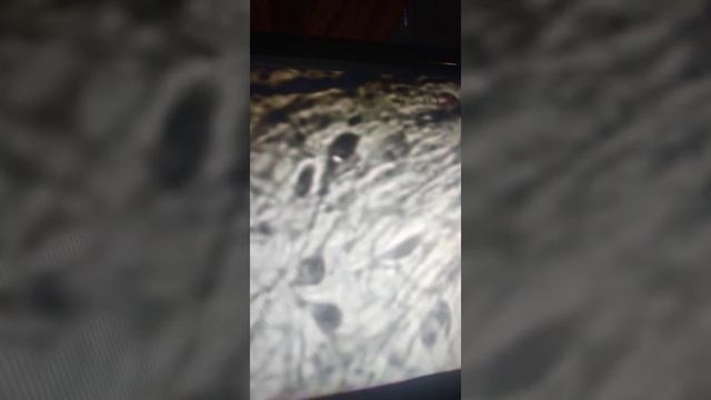 Бехтерева. Мозг. смотреть онлайн