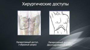 Эхинококкоз печени. Современные методы диагностики и лечения
