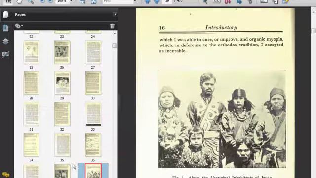 The Cure of Imperfect Sight by Treatment Without Glasses by Ophthalmologist William H Bates смотреть онлайн