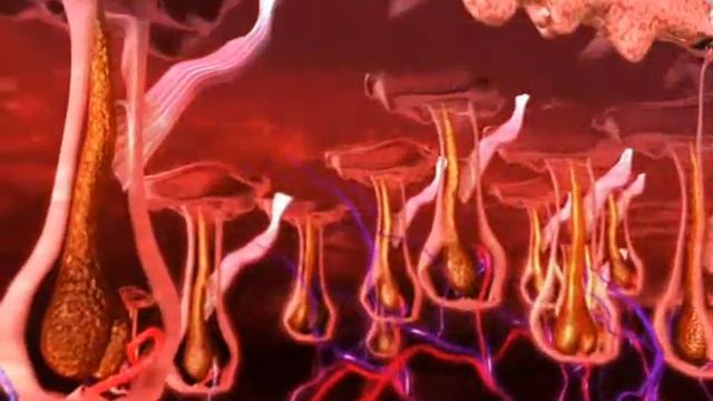 Simulación láser soprano смотреть онлайн