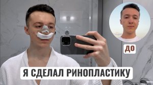 У МЕНЯ ТЕПЕРЬ НОВЫЙ НОС