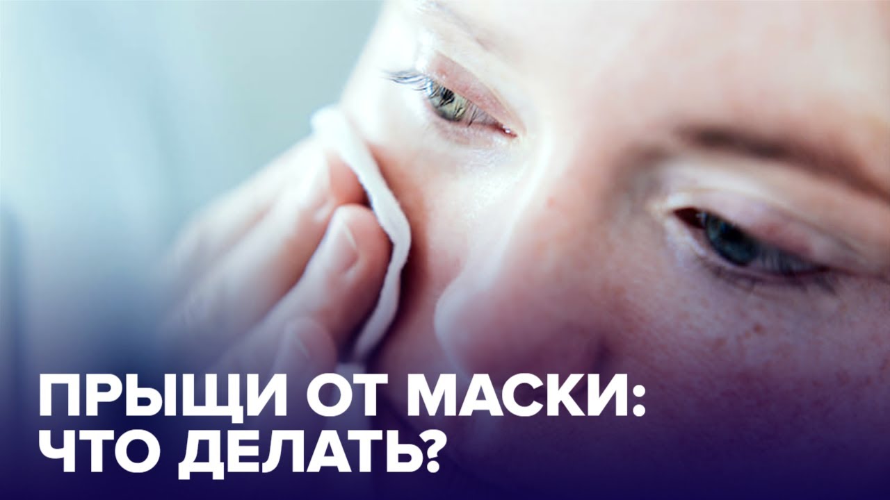 Акне от МАСОК. Как ИЗБЕЖАТЬ?