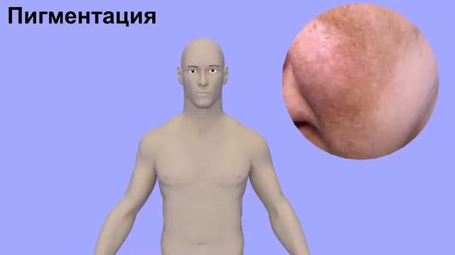 Морфологические элементы кожи | Как выглядят? | Medanatfarm смотреть онлайн