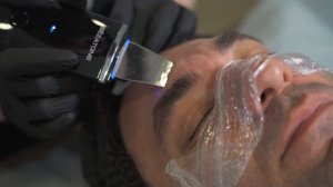 Ультразвуковая чистка лица и всесезонный миндальный пилинг Medic Control Peel