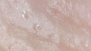 Как выглядят потовые железы