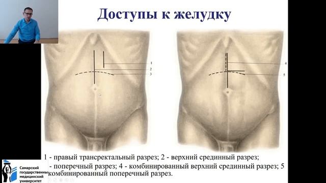 Вебинар "Клиническая анатомия желудка"
