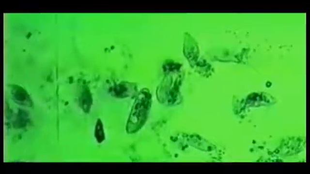 Гибель паразитов. Съемка под микроскопом. смотреть онлайн