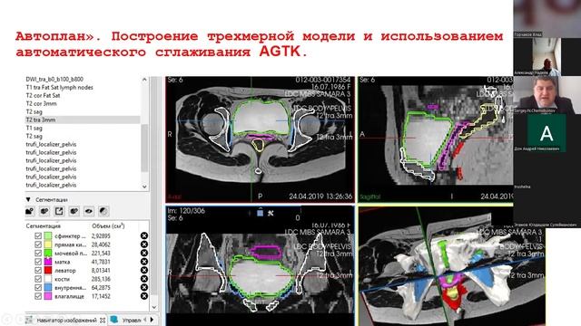 Чемидронов С. "Цифровые трехмерные модели органов человека, как элемент изучения клинич. анатомии"