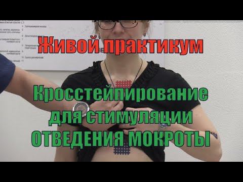 Кросстейпирование для стимуляции отведения мокроты