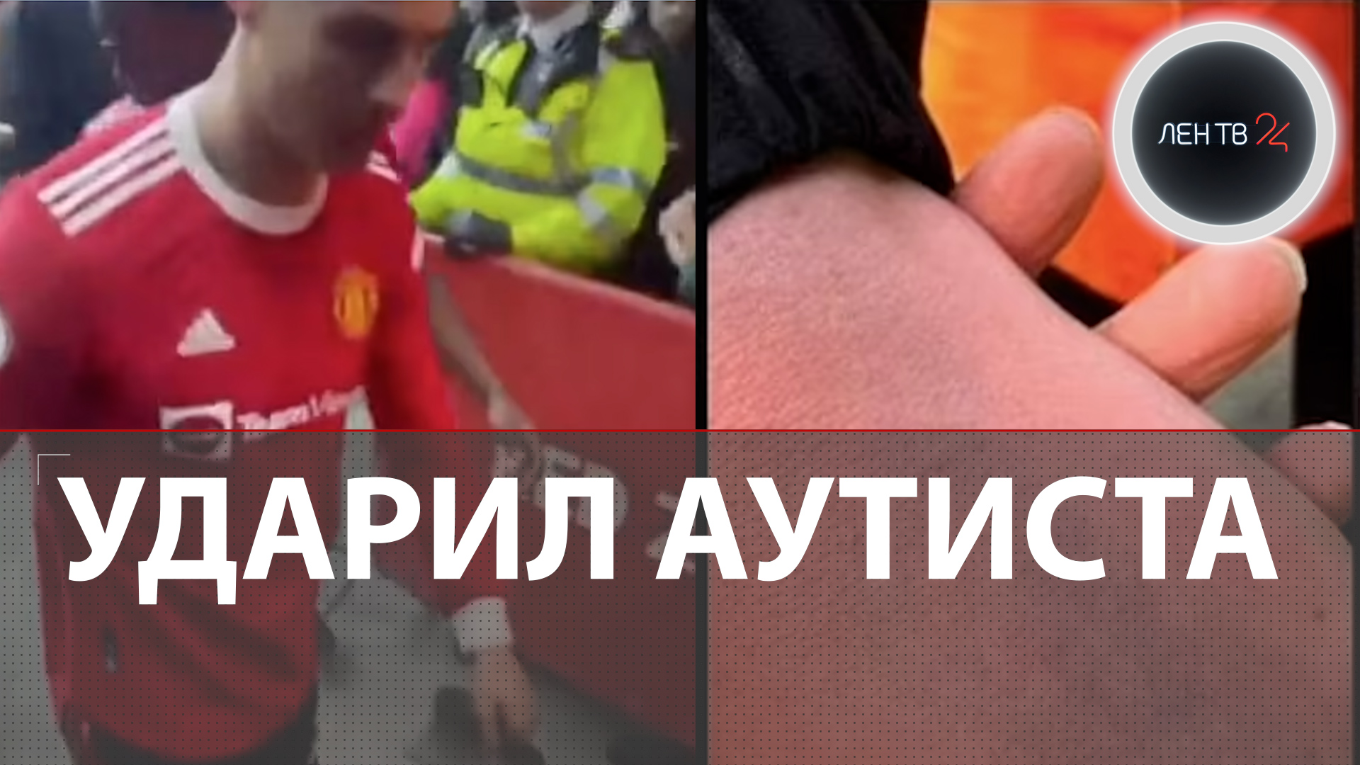 Роналду ударил аутиста | Полиция изучает видео после матча «Эвертон» - «Манчестер Юнайтед»