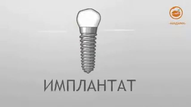 Почему имплантация зубов лучше обычного протезирования смотреть онлайн