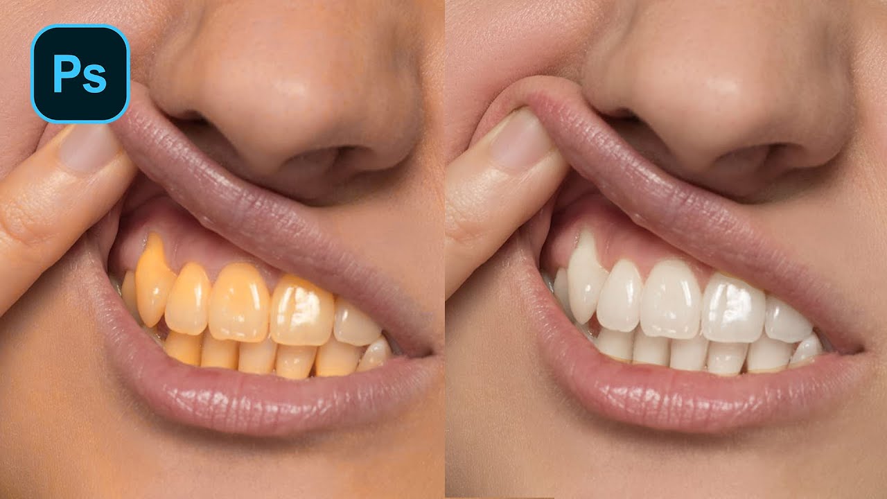 На фото сделать зубы белыми онлайн