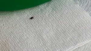 Как правильно вытащить клеща у человека самостоятельно в домашних условиях. 6 шагов