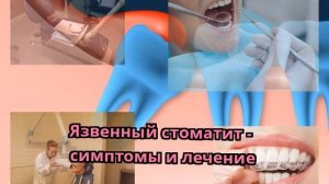 Язвенный стоматит - симптомы и лечение