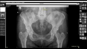 Обучающее видео “Калибровка изображений”.