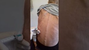 Пункция плевральной полости ОМОКБ