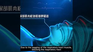 Умное устройство против храпа