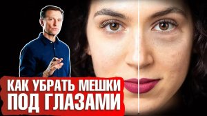Мешки под глазами: как убрать? Какая причина отека под глазами? 👁