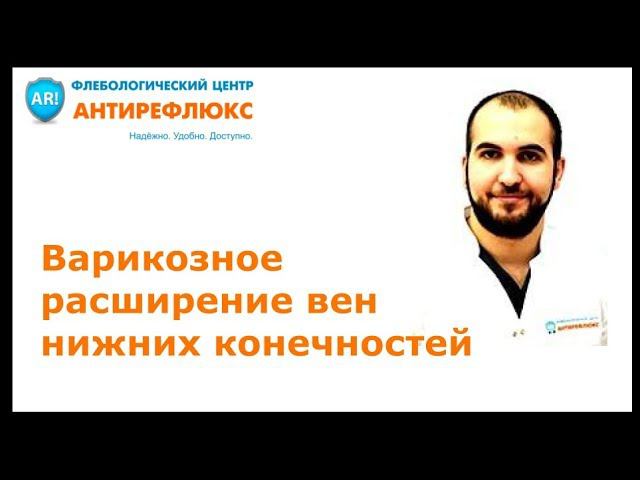 Варикозное расширение вен нижних конечностей