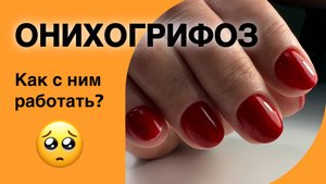НОГТИ КЛЮЮТ И ТРЕСКАЮТСЯ - что делать?