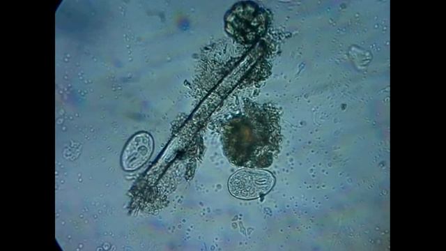 Бактерии смотреть онлайн