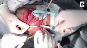 Как проходит операция на глазах