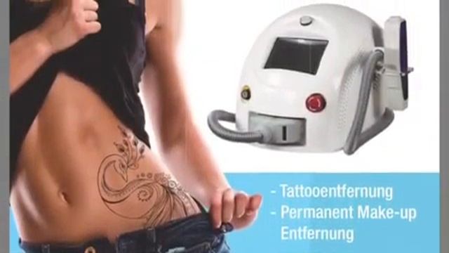 Лазерное удаление татуировок и татуажа в Берлине смотреть онлайн