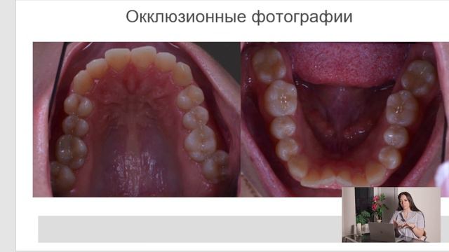 Анализ клинического случая №2 смотреть онлайн